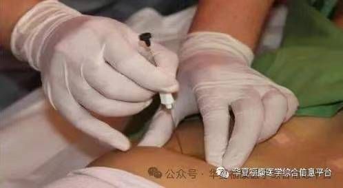 6月督脉通埋线疗法与中式埋线培训班