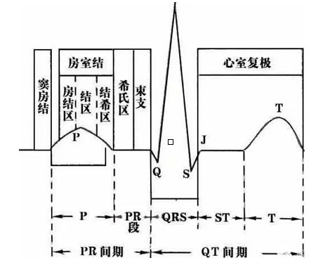 心电图