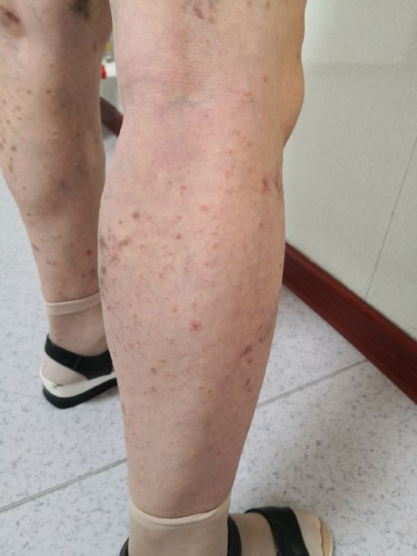 艾滋病的英文