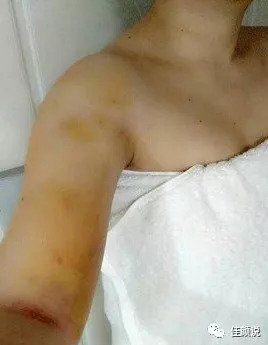 https://img.miyanlife.com/mnt/timg/180907/11394T622-1.jpg
