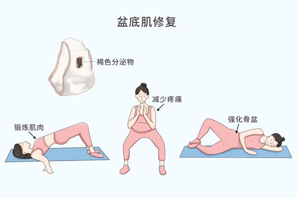 产后修复必做三大项目是什么