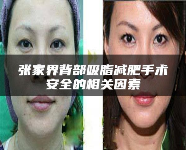 张家界背部吸脂减肥手术安全的相关因素