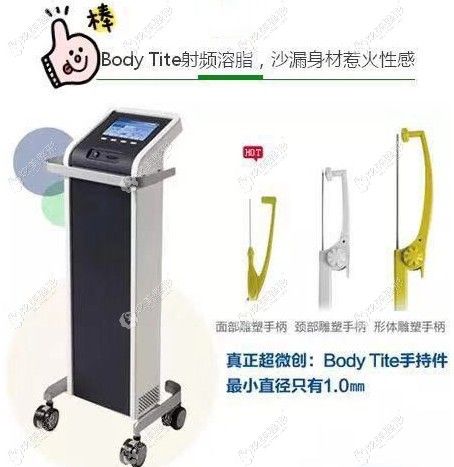 宁波艺星整形做宝丽太黄金微雕吸脂