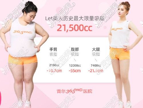 全身吸脂手术各部位吸脂量展示