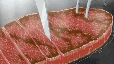 春雨医生