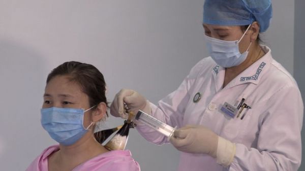 “小牛角罐”托起“大健康梦”——记内蒙古牛角拔罐疗法第三代传承人、锡林郭勒盟蒙医医院传统疗术科主任娜仁
