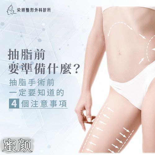 https://img.miyanlife.com/mnt/Editor/2022-01-30/61f634dd98772.jpg