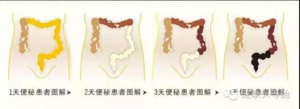 腸道健康決定你壽命的長短，腸道壽命就是人的壽命