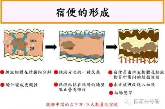 腸道健康決定你壽命的長短，腸道壽命就是人的壽命