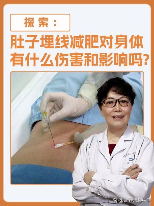 埋线减肥的危害有哪些