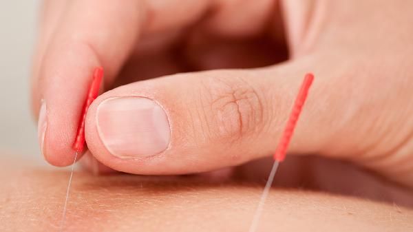 肚子上埋线减肥有什么后遗症