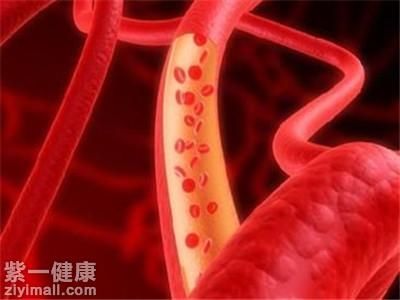 血液净化的危害有哪些 这三点你肯定不知道