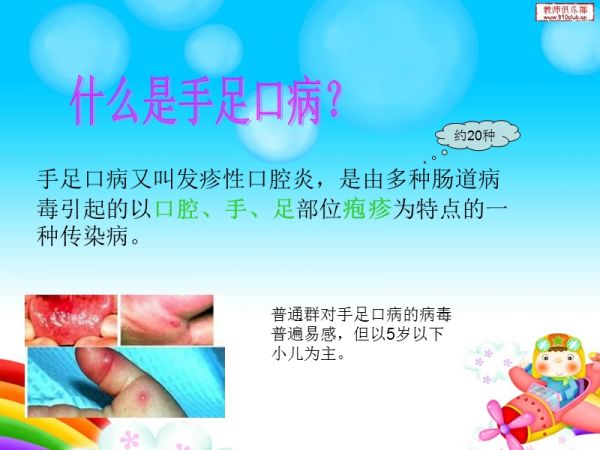 儿童常见传染病的预防.ppt_第3页