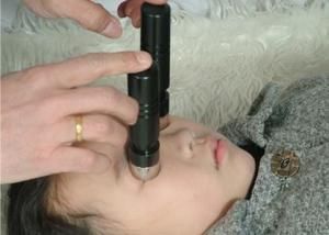 弧形磁疗仪