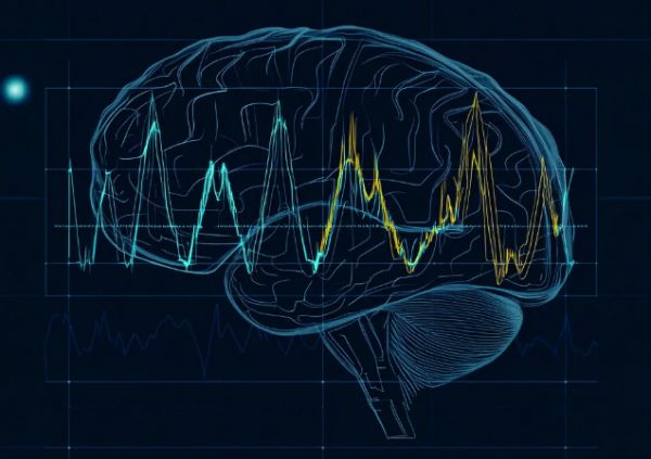 癫痫脑电图检查有哪些常见误区？