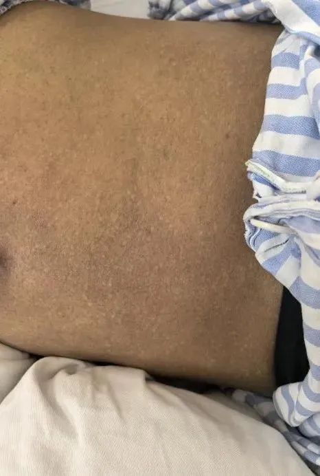 35岁女子突患怪病，一查竟是“砒霜”中毒！