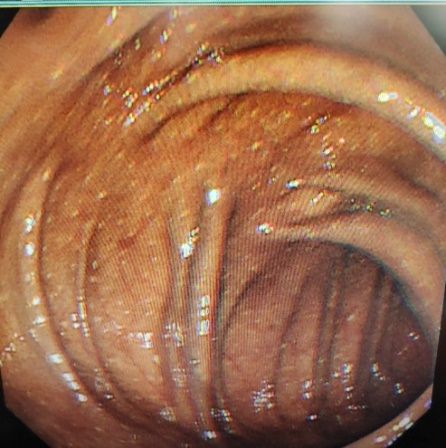 35岁女子突患怪病，一查竟是“砒霜”中毒！