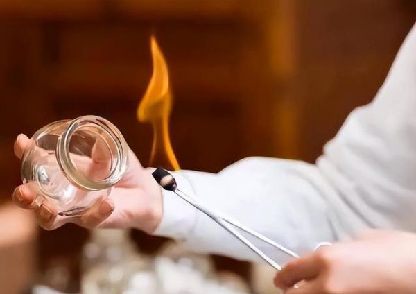 拔火罐后滿背紫印，真能排毒？真相讓人意外