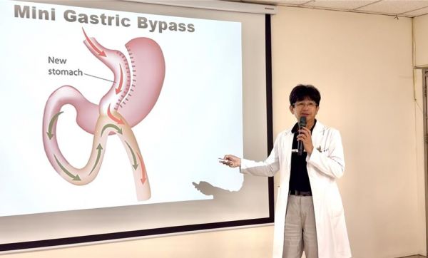 衛(wèi)生福利部臺(tái)中醫(yī)院一般外科主任蔡金宏說明患者7年前進(jìn)行縮胃合併胃繞道手術(shù)方式。（陳淑娥攝）