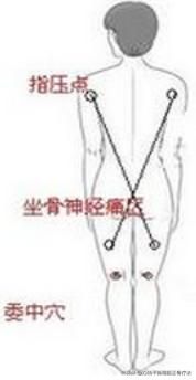 坐骨神經(jīng)痛的自我康復(fù)