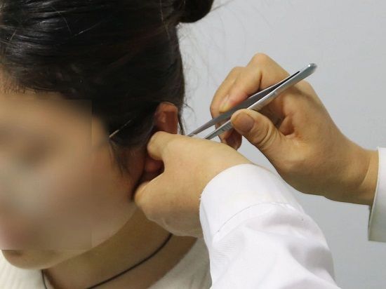 临沂市中医医院妇科中医适宜技术，助力女性健康