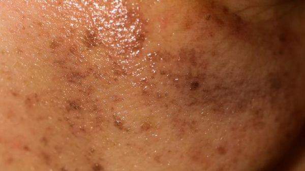 牛奶美容误区有哪些？这样喝牛奶不美容还伤身