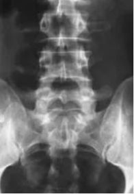 3岁男孩便秘一年没治好，这个病因很难想到……