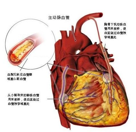 惊：吃了近30年黑木耳，这才明白就里！