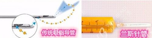 韩国365mc抽脂兰斯吸脂示意图