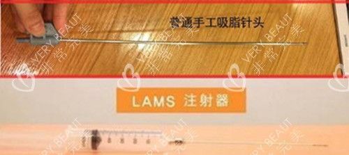 韩国365mc抽脂示意图