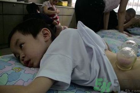小孩可以拔罐吗？宝宝能拔火罐吗？