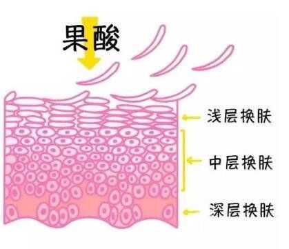 果酸如何作用于皮肤?