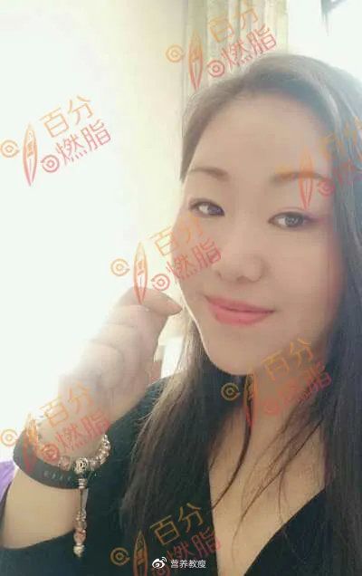 減肥后