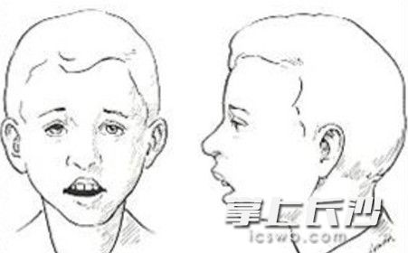 專(zhuān)家提醒，孩子長(zhǎng)期張口睡覺(jué)可能會(huì)影響顏值、牙齒發(fā)育及成年后的健康。