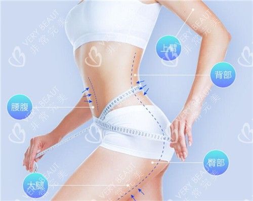 吸脂部位示意图