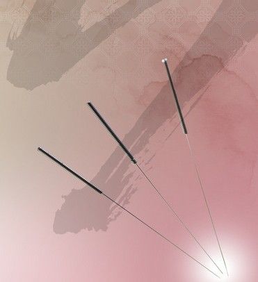 中醫(yī)健康減肥,常用5種的針灸減肥方法