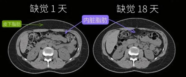 這樣睡真的能減肥！看看你適不適合→