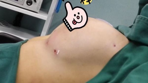 腹部減脂的方法_減腹部減肥法_腹部減肥最有效的方法視頻教程