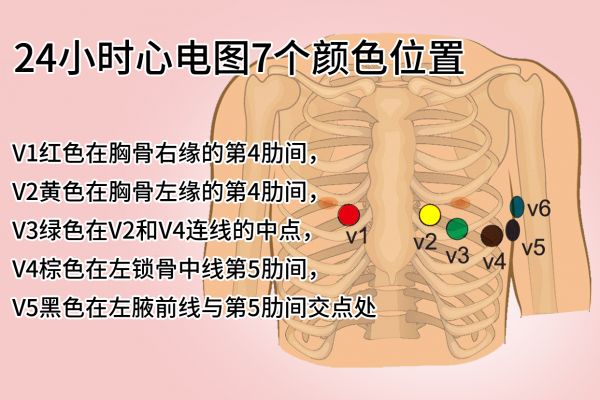 24小时心电图7个颜色位置图
