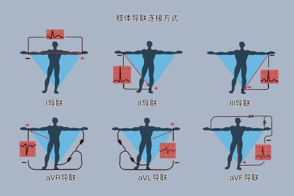 肢体导联连接图
