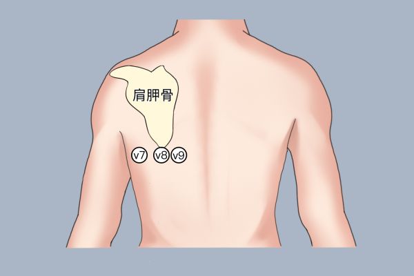 V7-V9导联连接图