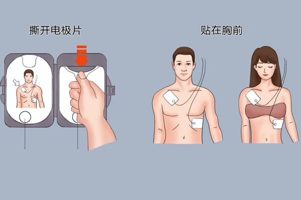 贴片流程图