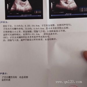 奧利司他膠囊(賽尼可)作用功效好嗎？