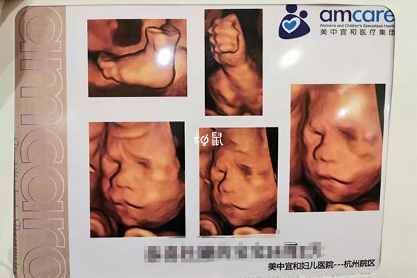 24周胎兒已經(jīng)充滿了子宮