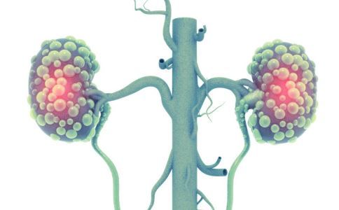 尿毒症早期症状 尿毒症的早期症状 尿毒症早期症状表现