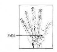 牙痛點(diǎn)圖片
