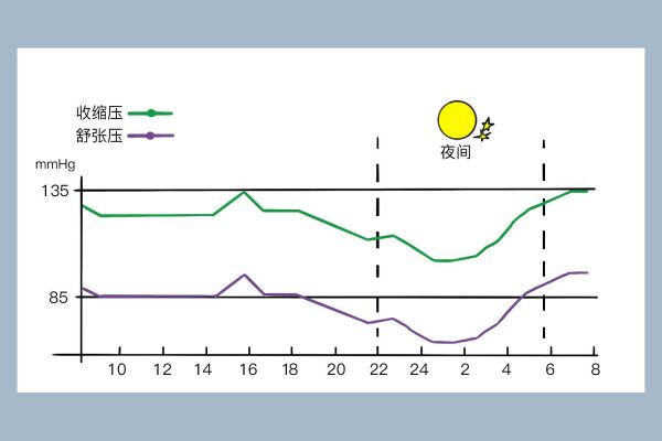 勺型血压曲线图