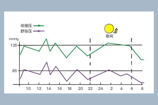非勺型血压曲线图