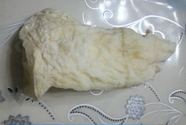 如何理解肿瘤的分期、分类、分型及分级？