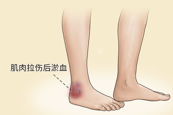 经常跑步的好处和坏处